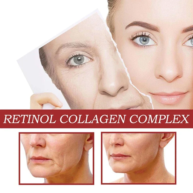 Crema para ojos con Retinol, barra multibalm de colágeno, Reduce las arrugas, bolsa para ojos, ácido hialurónico, antiojeras, hinchazón, productos para el cuidado de los ojos