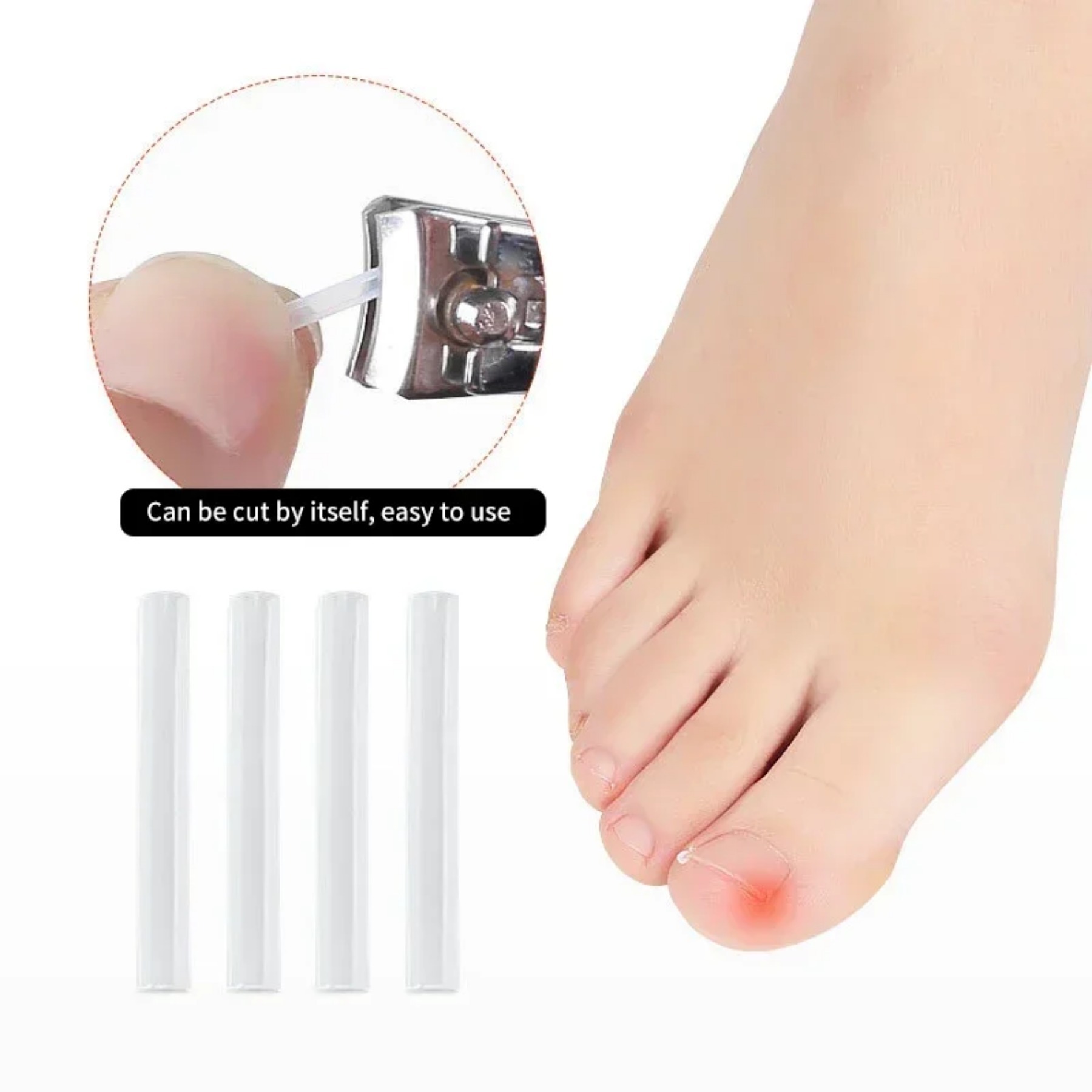 50Pcs Ingrown Toenail Tool Ingrown Toe Nail Treatment Elastic Patch Sticker Straightening Clip Brace Pedicure Tool