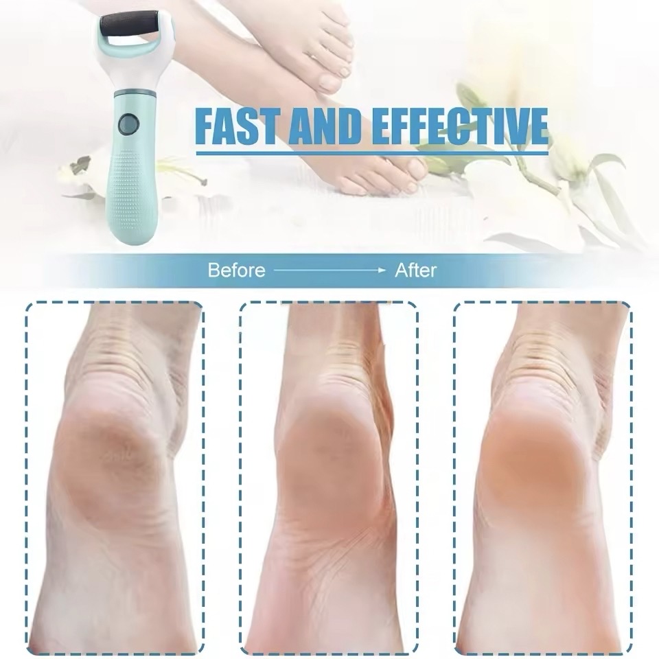 Electric Foot Callus Remover Kit, Rechargeable Waterproof Foot Scrubber File, Professional Pedicure Tools kit Feet Care for Dead
