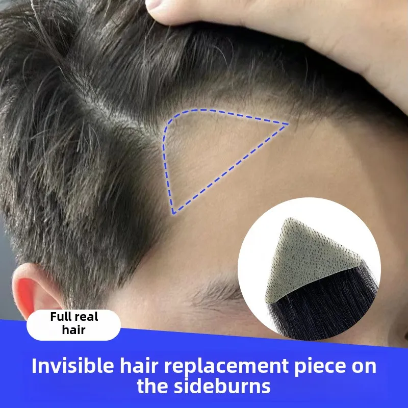 1 par de parches de repuesto para cabello humano, quemaduras accidentales sin cabello para hombres, cinta recta para pérdida de línea de cabello de 15cm en tupé de repuesto