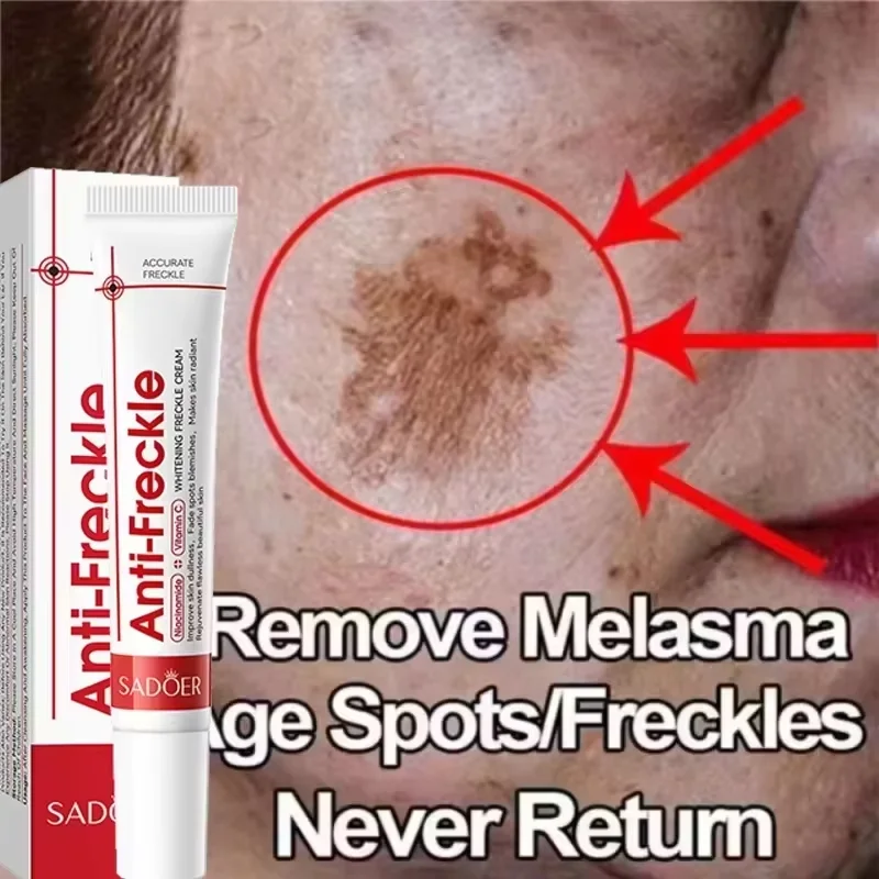 Effective Whitening Freckles Face Cream Dark Spot Corrector Remove Melasma Fade Melanin Pigmentation Brighten Skin Care Products
