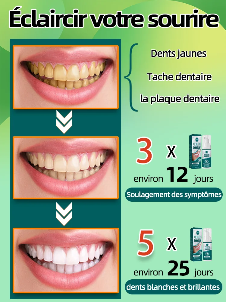 Blanchiment des dents, élimination du tartre