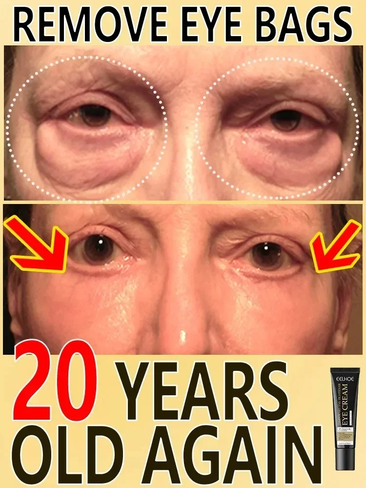 Crema para los ojos con arrugas tensoras, crema de masaje para los ojos, elimina las bolsas de grasa de los ojos, levantamiento de hinchazón, reafirmante, nutre suave, cuidado de la piel de los ojos, 7 días