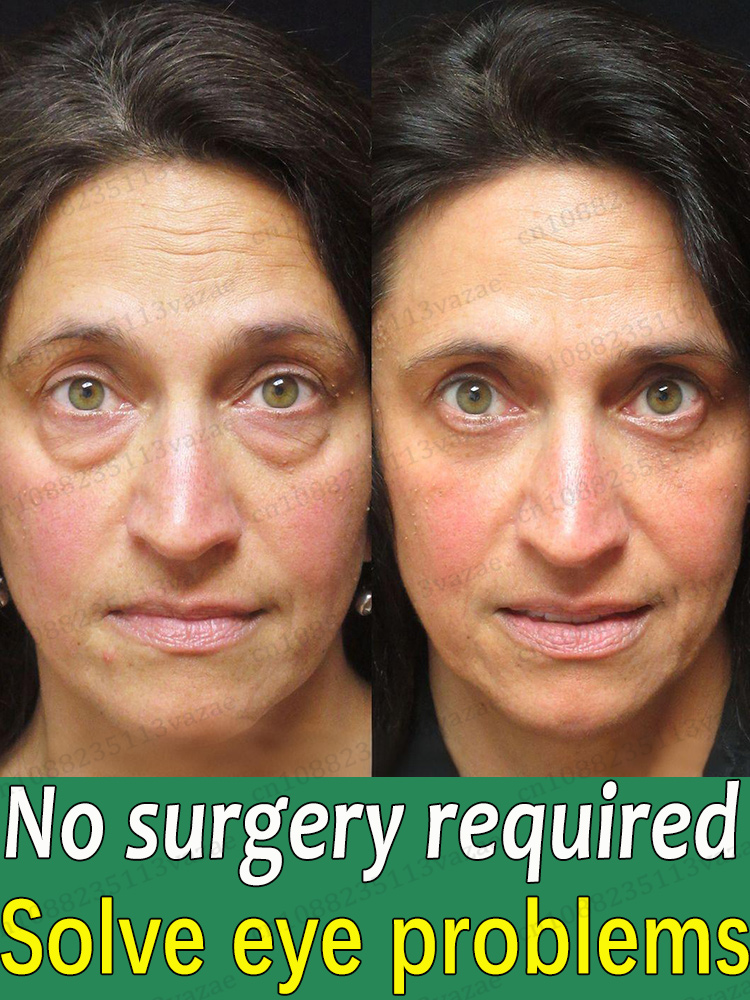 оставайся подогревом эссенции для глаз, сохраните свои глаза навсегда молодые