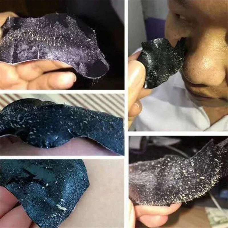 10 個鼻にきび除去マスクディープクリーニングシュリンク毛穴にきび治療マスク