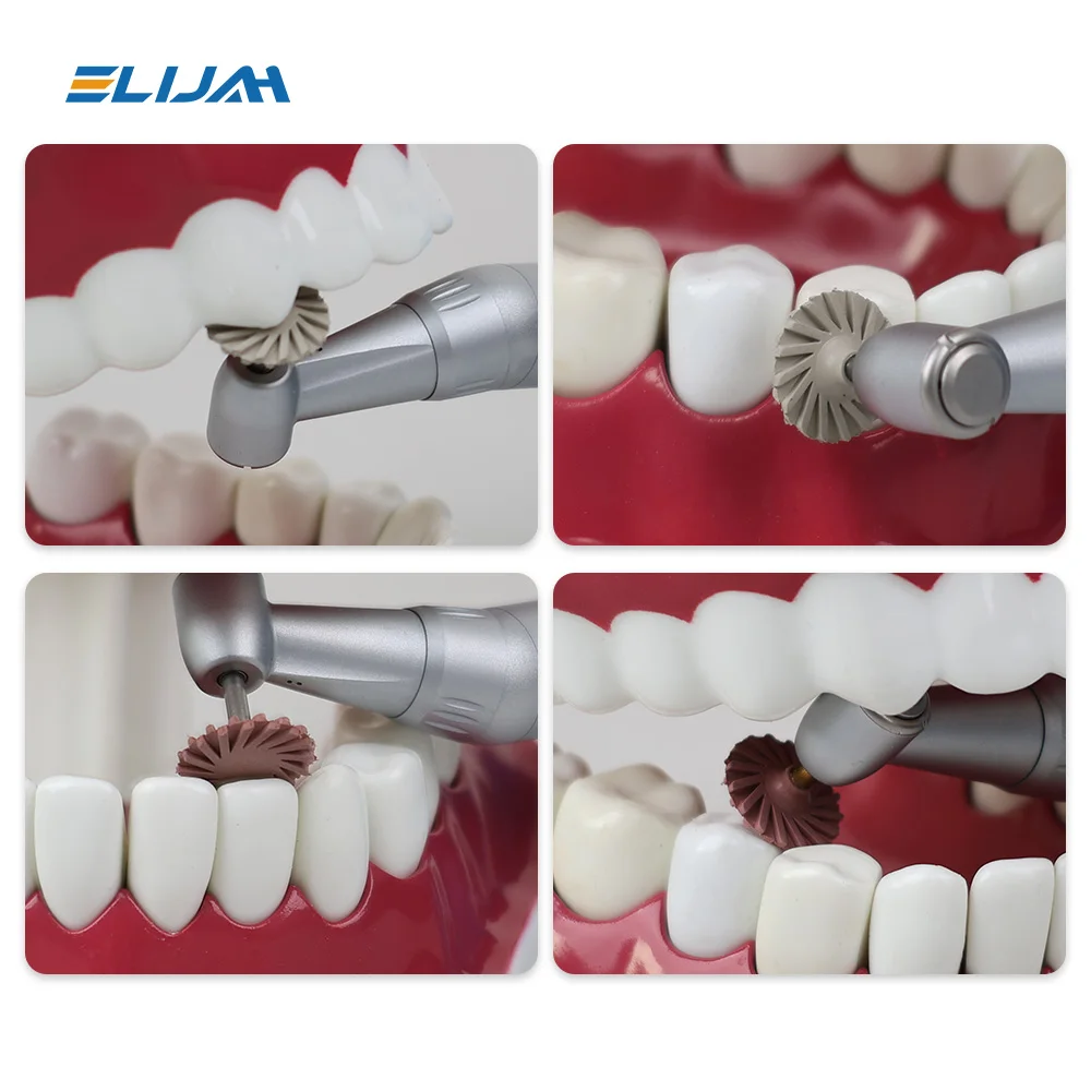 6 ชิ้น/กล่องทันตกรรมเรซินคอมโพสิตแผ่นขัดยางขัด 14 มม.3 สีเกลียว Flex แปรงทันตกรรมเครื่องมือ