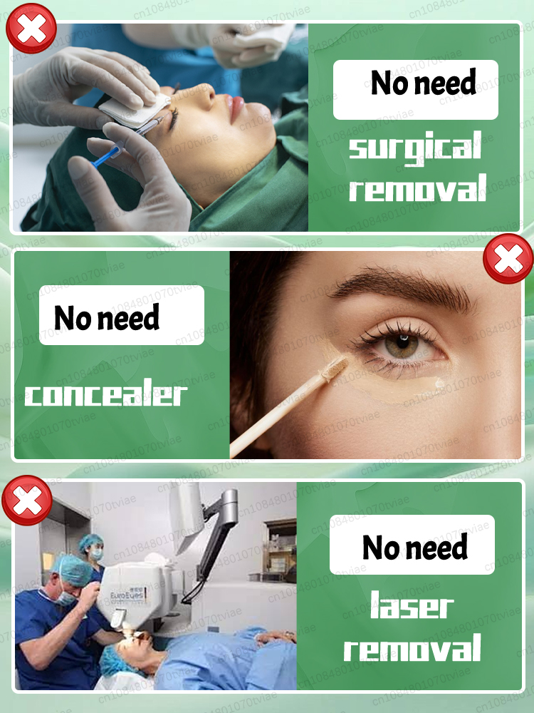 оставайся подогревом эссенции для глаз, сохраните свои глаза навсегда молодые