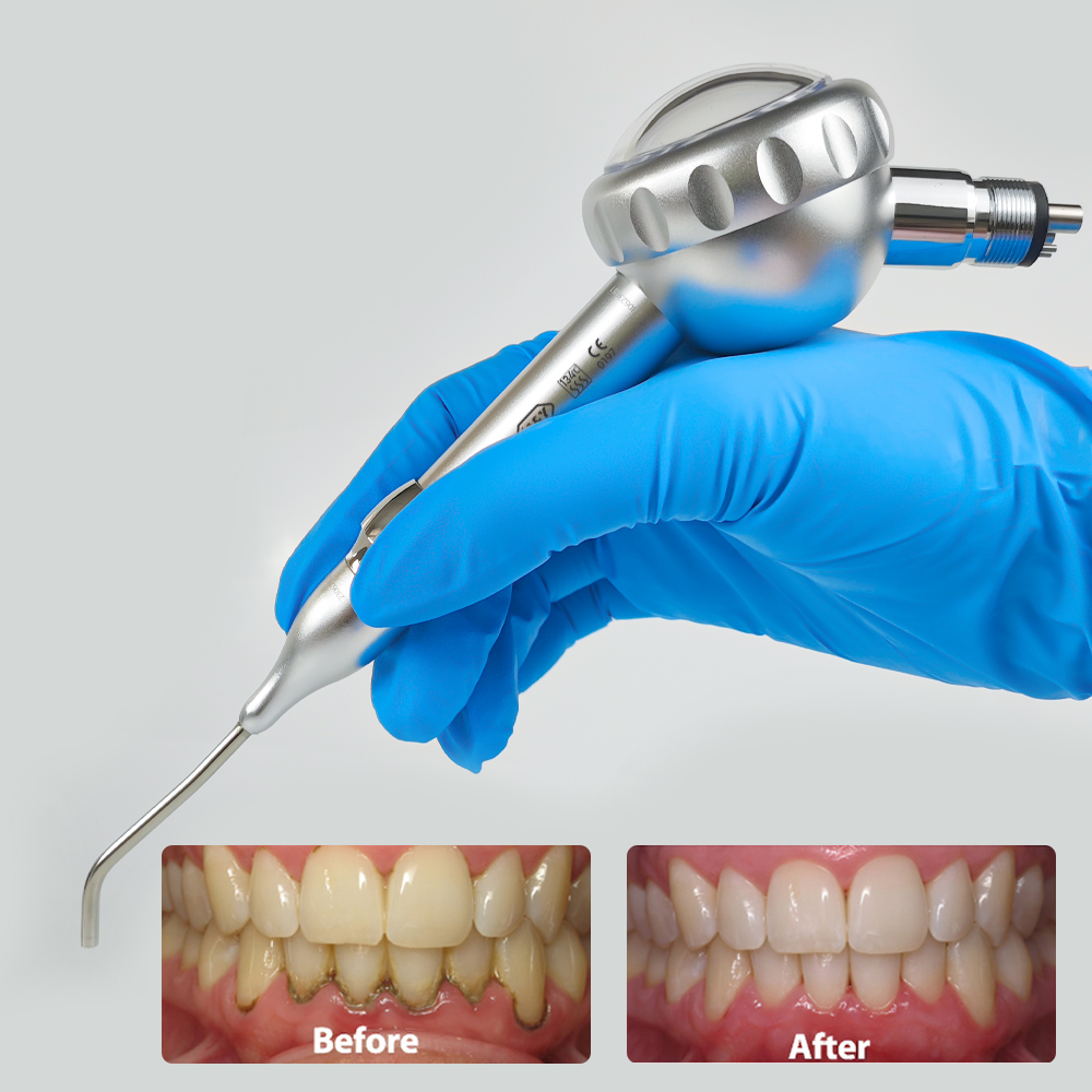 Dental Air Prophy Handpiece Unit Spray Polisher Air Jet Sandblasting Teeth Whitening Polishing Tools Dentistry Equipment