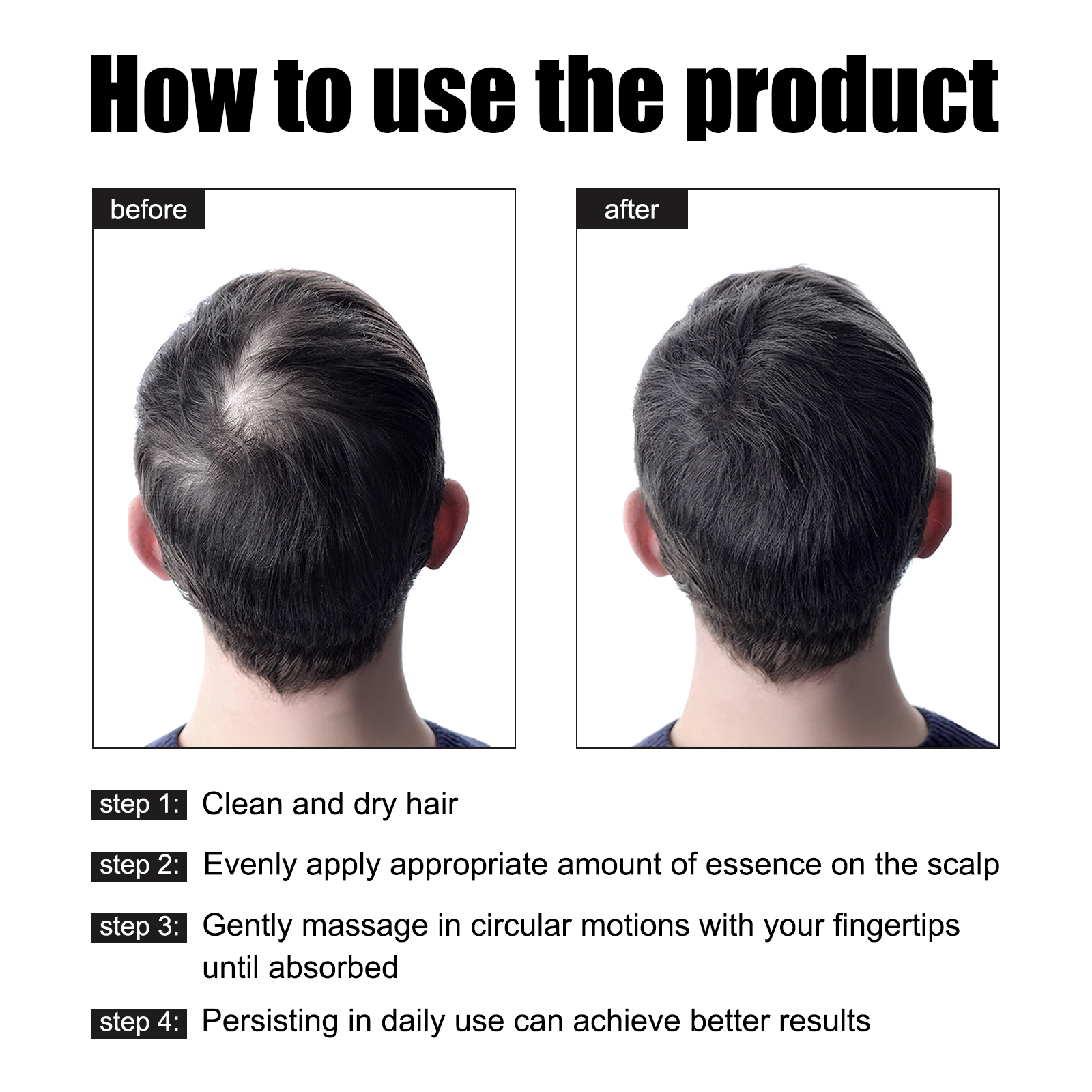 Óleo essencial de crescimento capilar de alecrim, nutrição profunda do couro cabeludo, anti perda de cabelo, reparação de danos, óleo de recrescimento, tratamento de desbaste