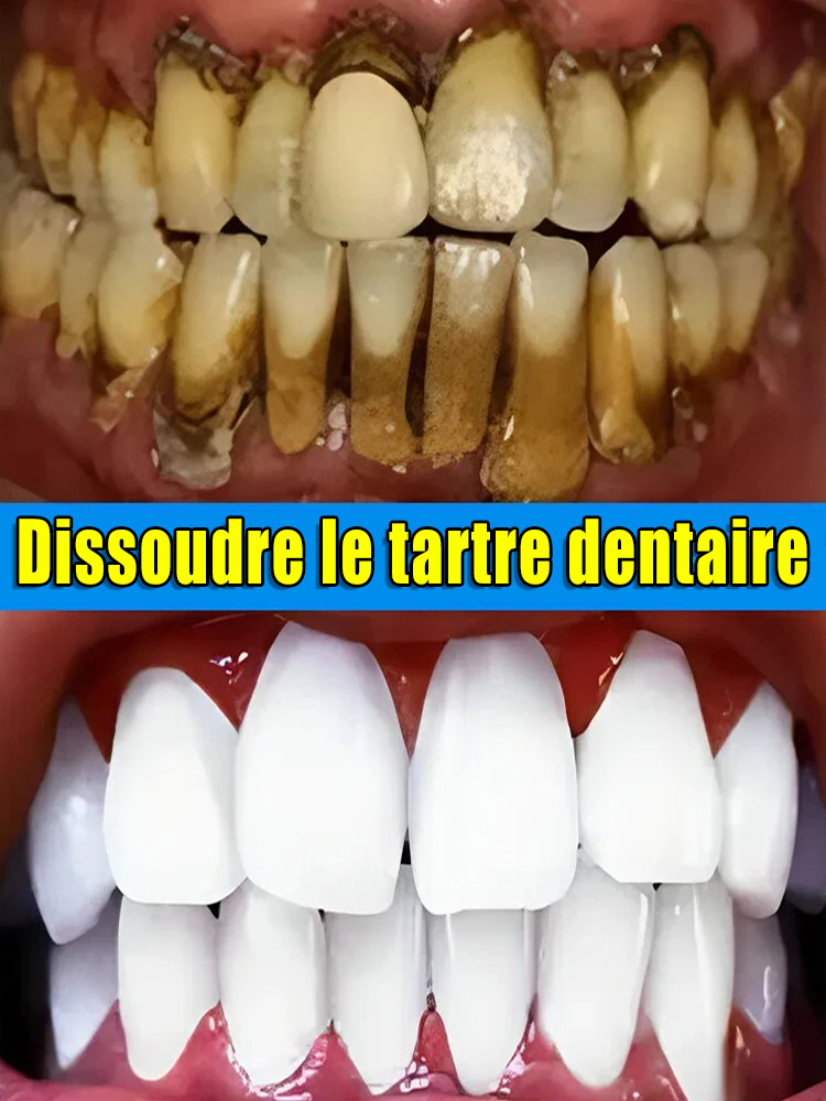 Résoudre les problèmes dentaires