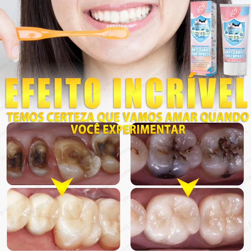 99% ᴅᴀs ᴘᴇssᴏᴀs ʀᴇᴄᴏᴍᴘʀᴀ, ᴠᴇɴᴅᴀ ᴏ̨ᴜᴇɴᴛᴇ, ʀᴇᴘᴀʀᴀʀ ᴀ ᴄᴀ́ʀɪᴇ ᴅᴇɴᴛᴀ́ʀɪᴀ