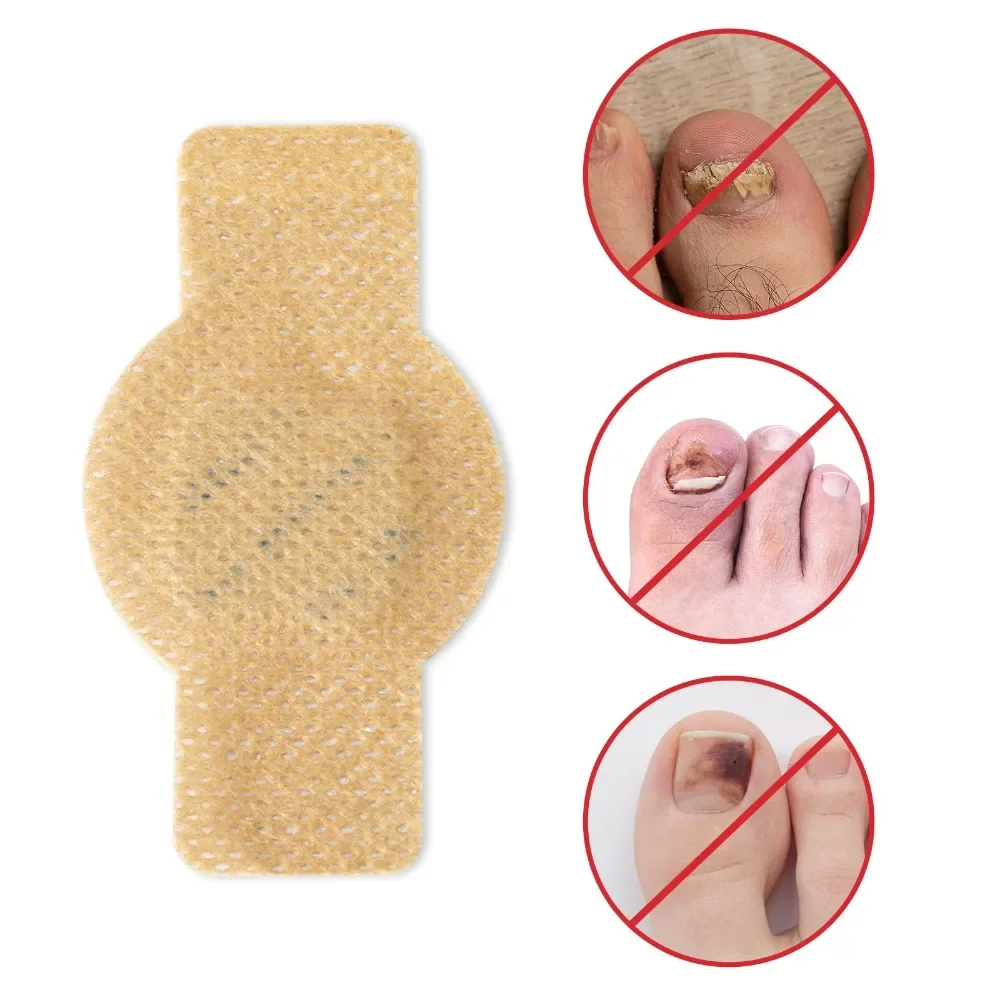 21 Uds parche para hongos en las uñas de los pies parches impermeables para reparación de uñas pegatinas de corrección encarnadas para uñas descoloridas o dañadas