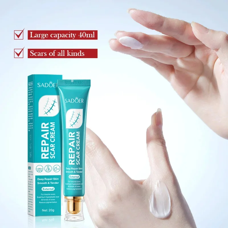 Crema para eliminar cicatrices, reparación de estrías, quemaduras de acné, ungüento quirúrgico para cicatrices de acné, tratamiento a base de hierbas, Gel blanqueador, belleza, cuidado de la salud
