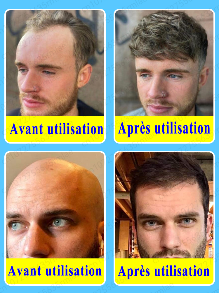 Le petit flacon bleu WPRBREGT nourrit en profondeur le cuir chevelu, revitalise les follicules pileux et favorise une croissance rapide des cheveux en 7 jours