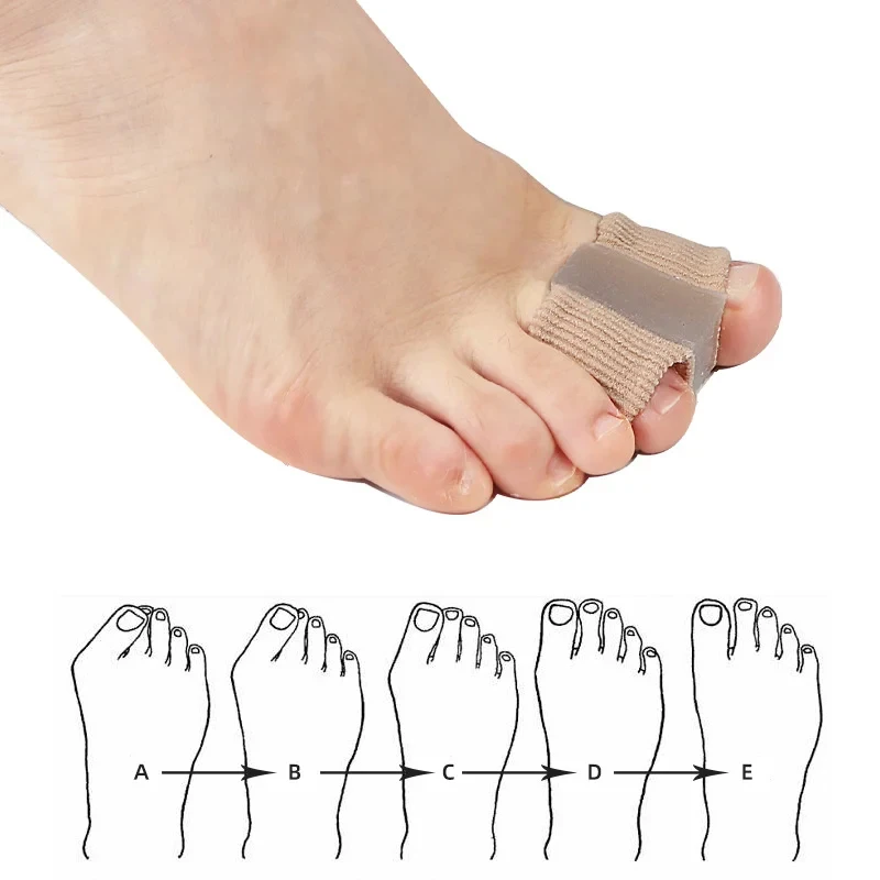 1PCS Silicone Toe Spreader Finger Separator Valgus Corrector Thumb Correction Straightener Foot Care Orthopedic