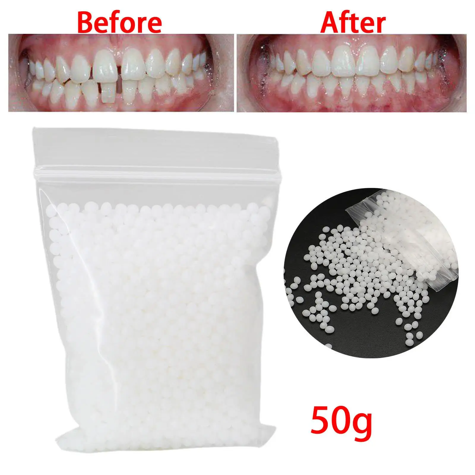Kit de reparación temporal de dientes 50G, cuentas adhesivas, chapa de dientes falsos moldeable