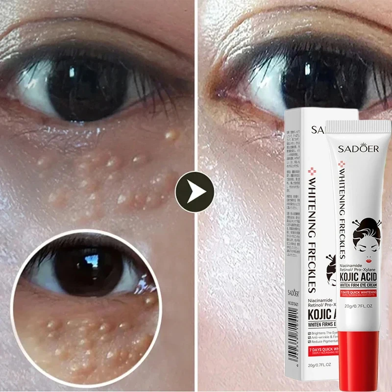 Fat Granules Remover Eye Cream Anti-Puffiness Anti Inflammatory Reduce Dark Circles Fade Fine Lines Repair Barrier Firm Cream