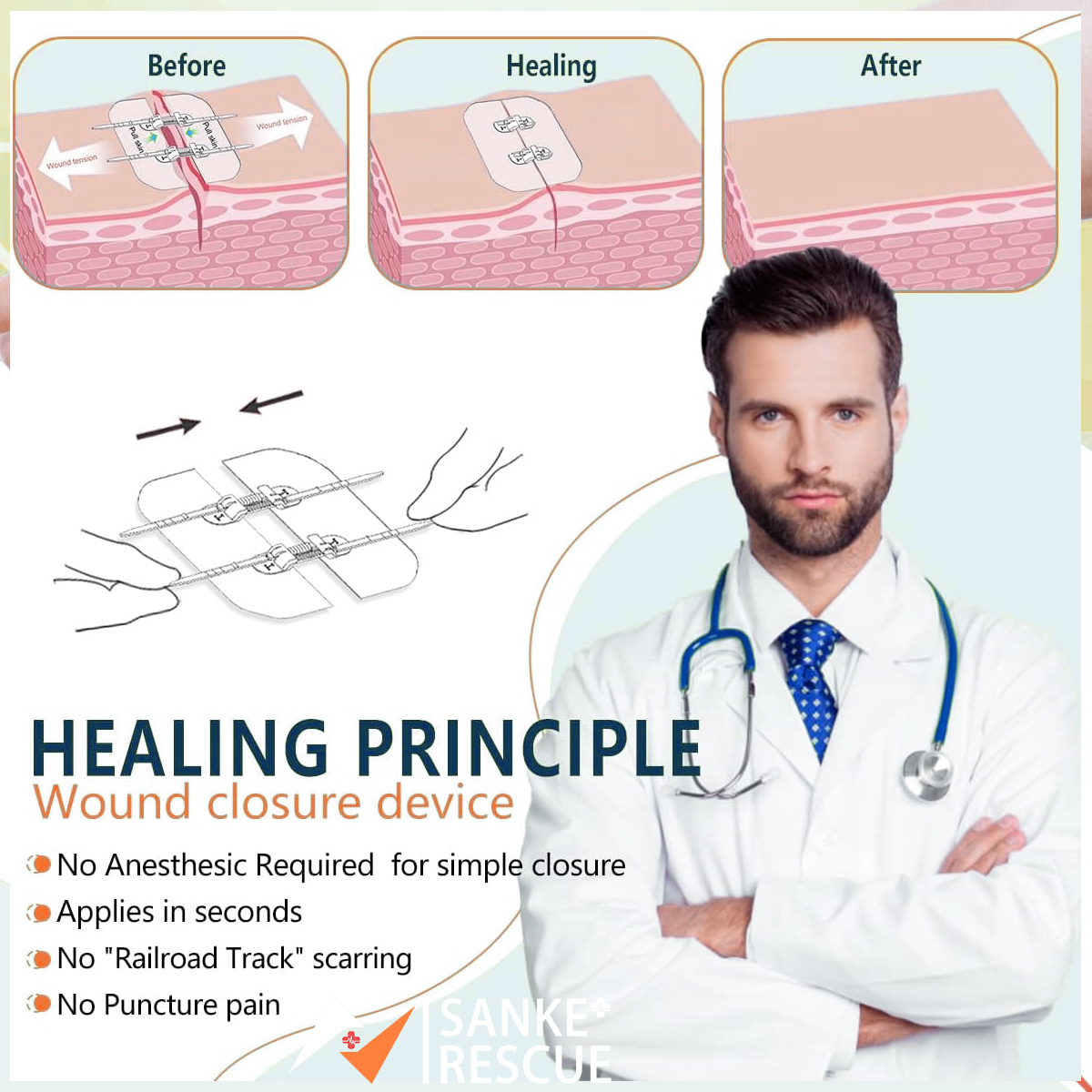 Dispositif de fermeture de plaie indolore, pansement à fermeture éclair, patchs de pansement sans Suture, réducteur de Suture à fermeture éclair