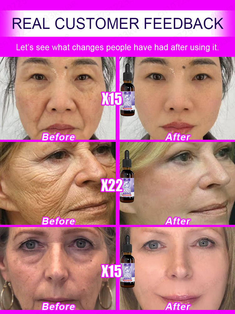 Без морщин, 20-летний младший