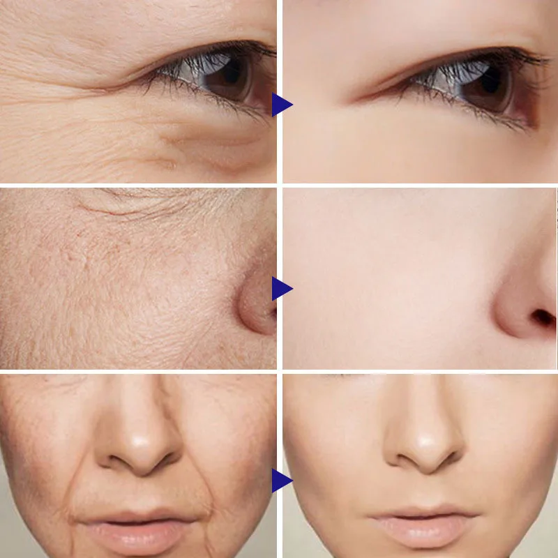 Crema para eliminar arrugas instantánea, antienvejecimiento, decoloración de líneas finas, Reduce las arrugas, Retinol, crema reafirmante, cuidado de la piel facial