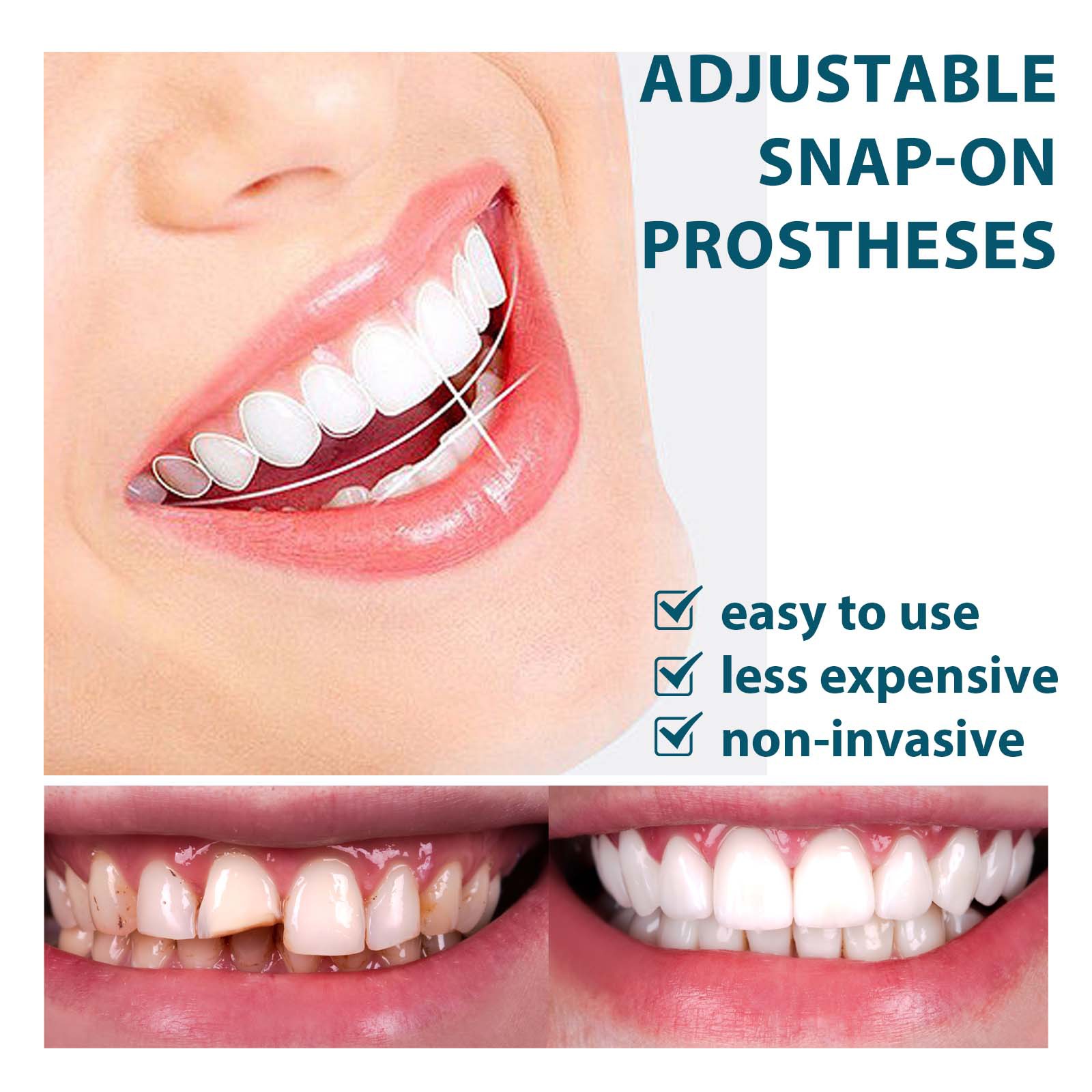2 pares de dentaduras postizas, dientes cosméticos, dientes artificiales reutilizables, sonrisa temporal, chapa superior y inferior de dientes postizos