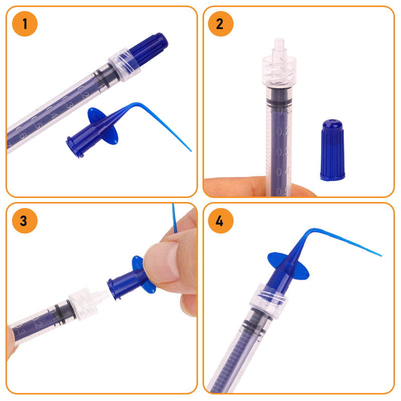 Dental Spritze Einweg Lieferung Spitze Endodontie Nadel Wurzel Kanal Applikator Parodontale Bewässerung Nadeln