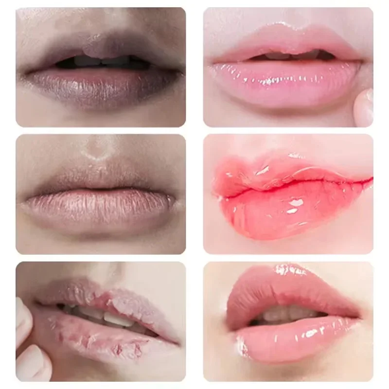 Labios Rosa fresco aclarante crema blanqueadora tratamiento eliminar humo oscuro labios bálsamo labial blanqueamiento hidratante esencia nutritiva
