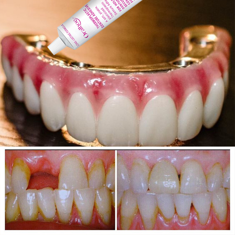 28 г клей для фиксации протезов, твердый стоматологический клей для фиксации протезов для улучшения комфорта, косметический клей для фиксации протезов