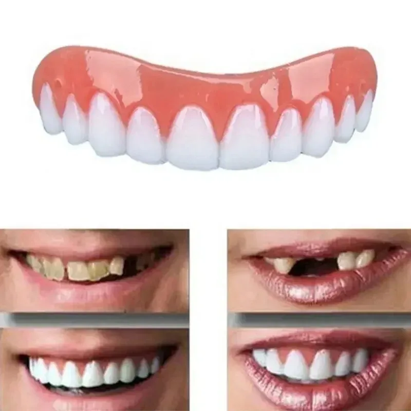 Cómodos dientes postizos sonrientes con relleno de pegamento para dientes, carillas superiores e inferiores desechables, maquillaje de dientes, diente falso temporal