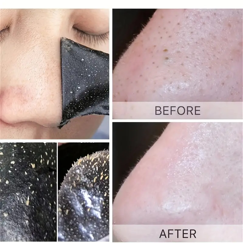 Maschera per la rimozione dei punti neri al carbone di bambù Strisce nasali Punti neri Macchie Maschera per il trattamento dell'acne Adesivo per il naso pulito profondo dell'acne del viso