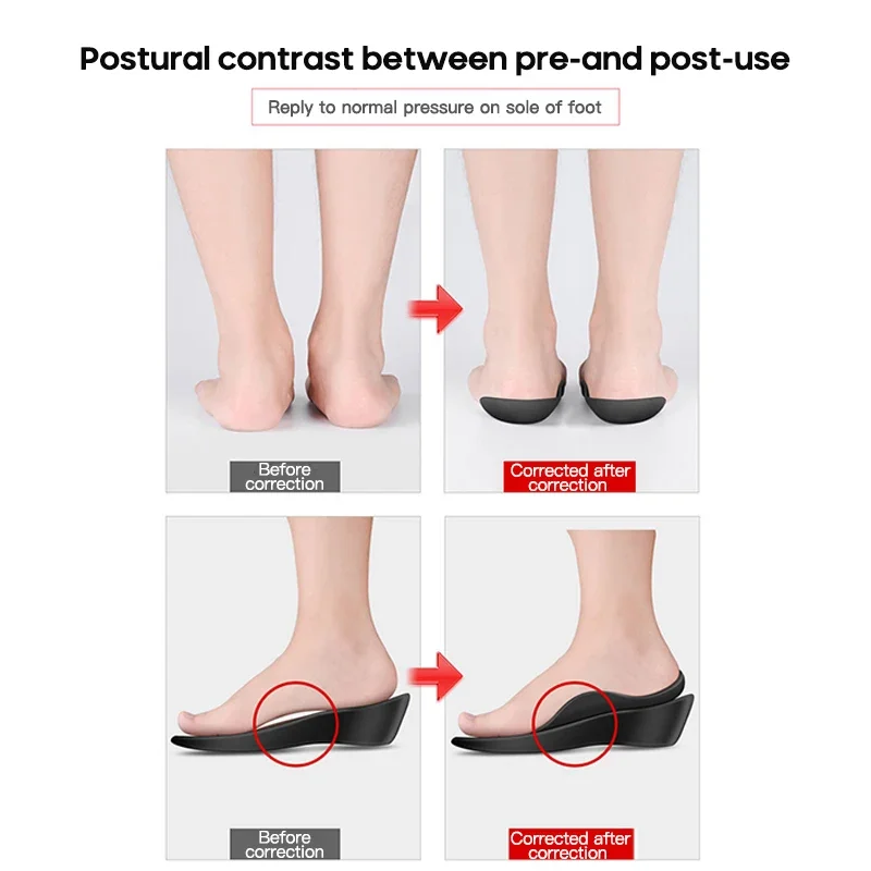 Flatfoot Orthotics Flatfoot Orthotics Cubitus Varus Orthopedic Feet Cushion O-shaped Legs Pads Foot Care Insoles Unisex 1 Pair