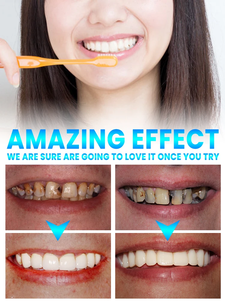 Repair tooth decay and whiten toothpaste