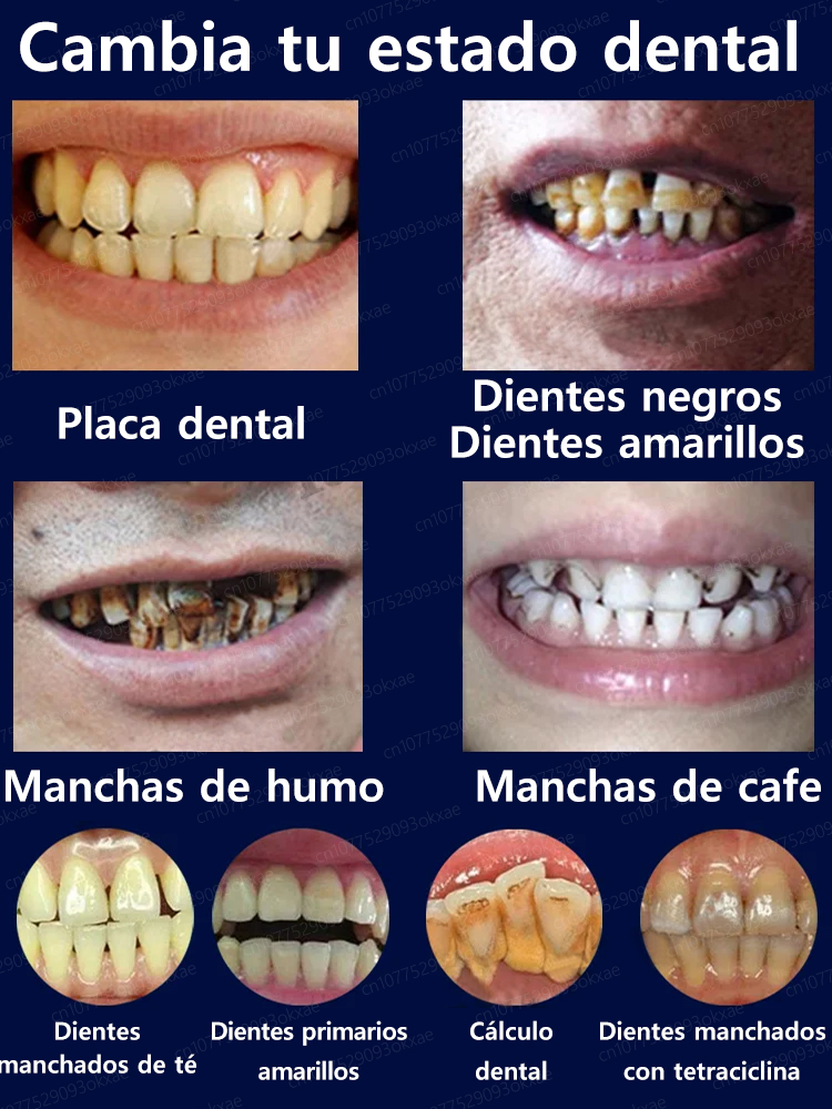 Blanqueamiento dental, restauración rápida y natural de las encías, críticas de usuarios abrumadoramente positivas
