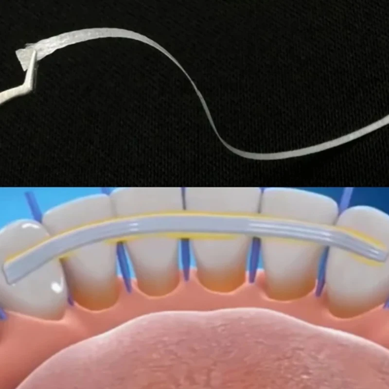 7 ชิ้น/กล่องทันตกรรมวัสดุยืดหยุ่นแถบไฟเบอร์ Glass Splint หลวมฟัน Fixation Strips Light Cure Bonding จัดฟัน Retainers
