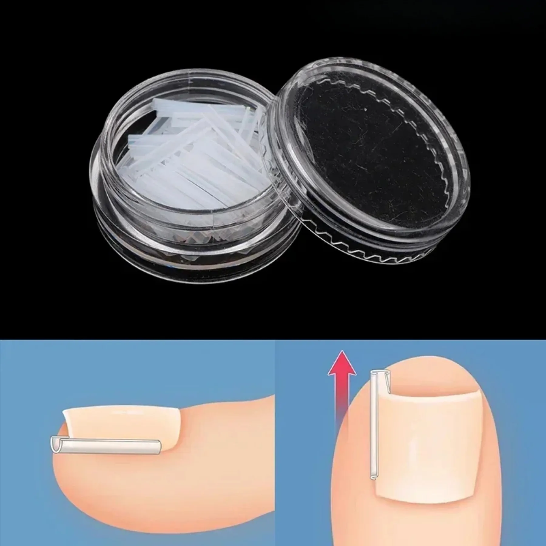 50Pcs Ingrown Toenail Tool Ingrown Toe Nail Treatment Elastic Patch Sticker Straightening Clip Brace Pedicure Tool