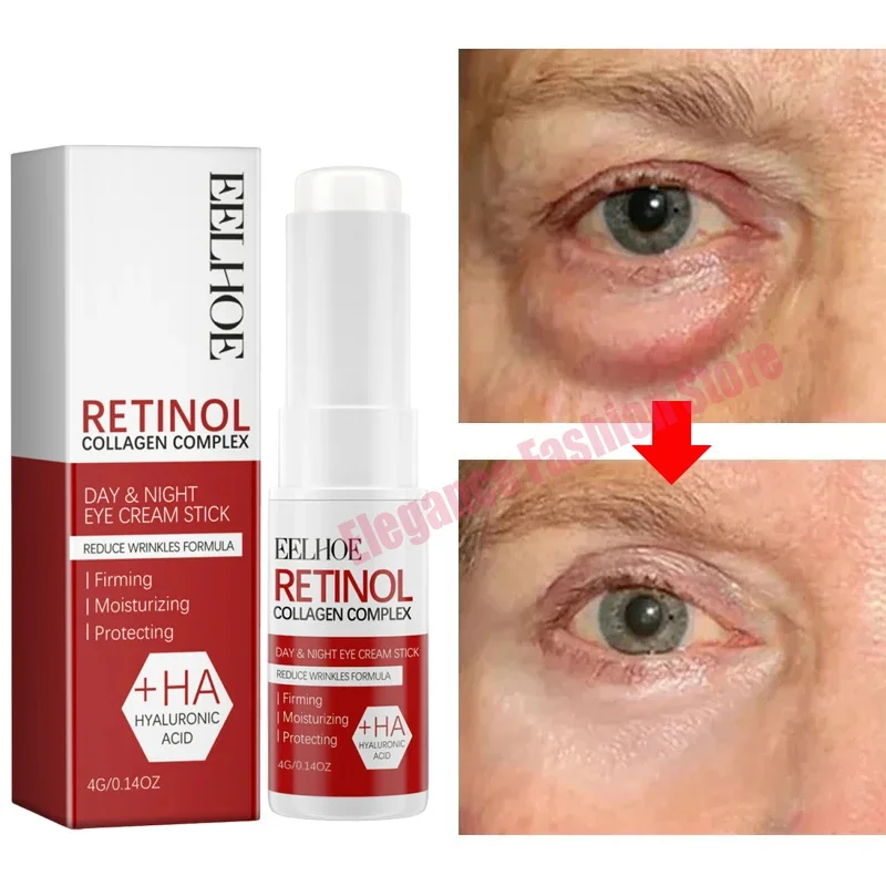 Bolsa de ojos instantánea, crema para eliminar los ojos, partículas antigras, ojeras, hinchazón, decoloración de líneas finas, brillo, belleza coreana, cuidado de los ojos