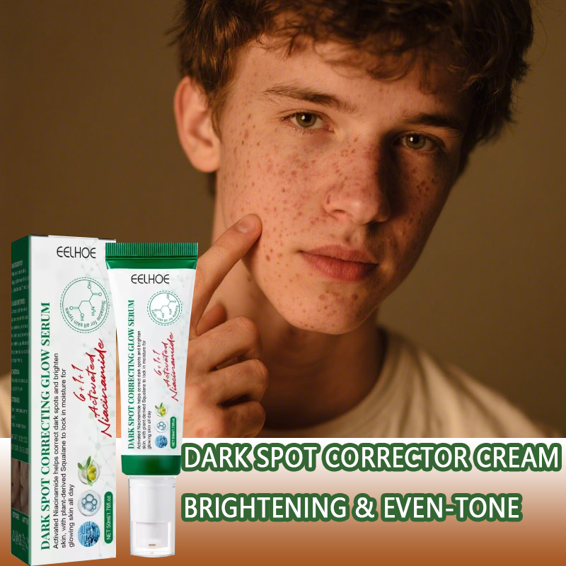 Crema correctora de manchas oscuras que reduce las manchas oscuras, el cuidado iluminador, hidrata y nutre la piel, reduce la melanina, desvanece las manchas, las pecas