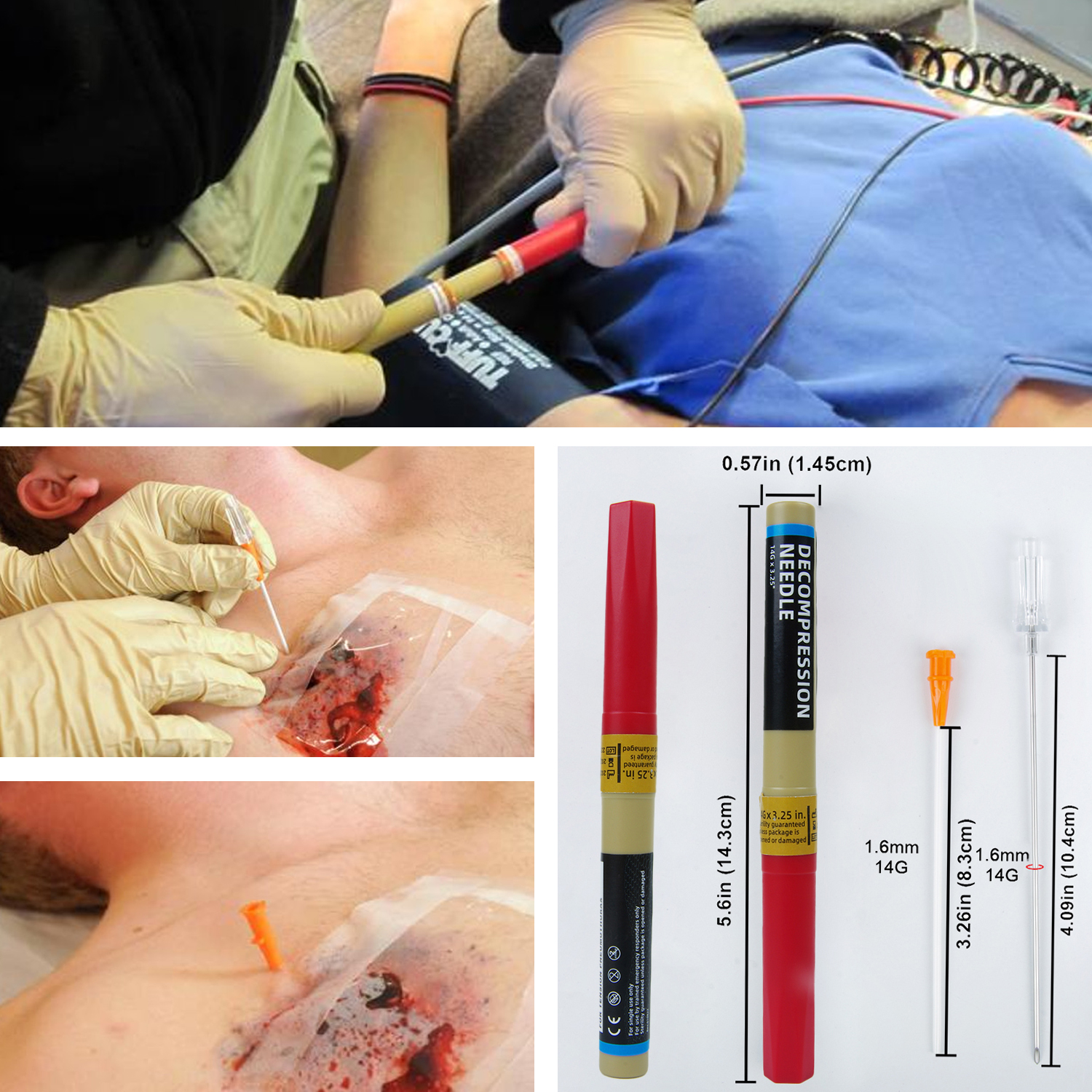 Sanke Rescue Pneumothorax Nadel Trauma Medical Ifak Brustkatheter Nadelkatheter 50g Nadel Dekompression Edc Erste-Hilfe-Set