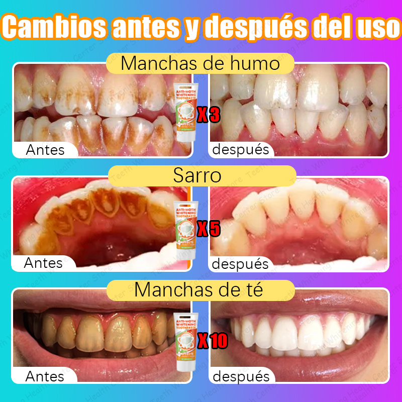 98% de tasa de recambio, puedes tener dientes saludables sin limpieza de dientes, recomendado por dentistas