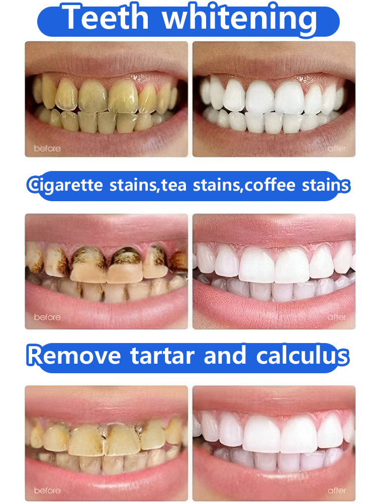 Sbiancamento dei denti, ripristino rapido e naturale delle gengive, recensioni degli utenti estremamente positive