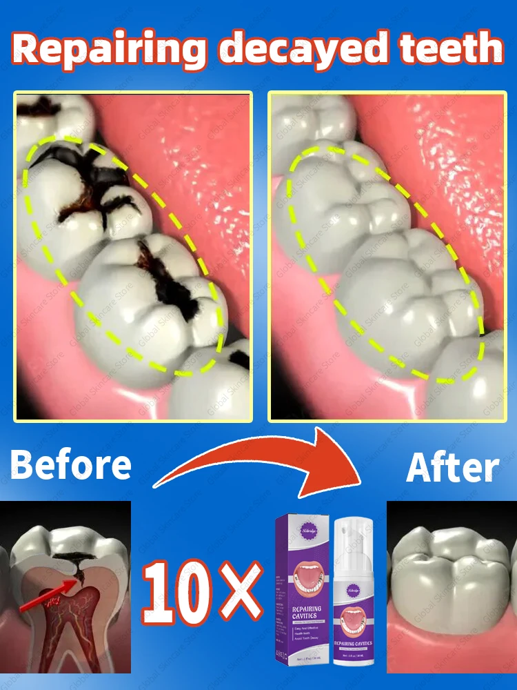 Solve all dental problems