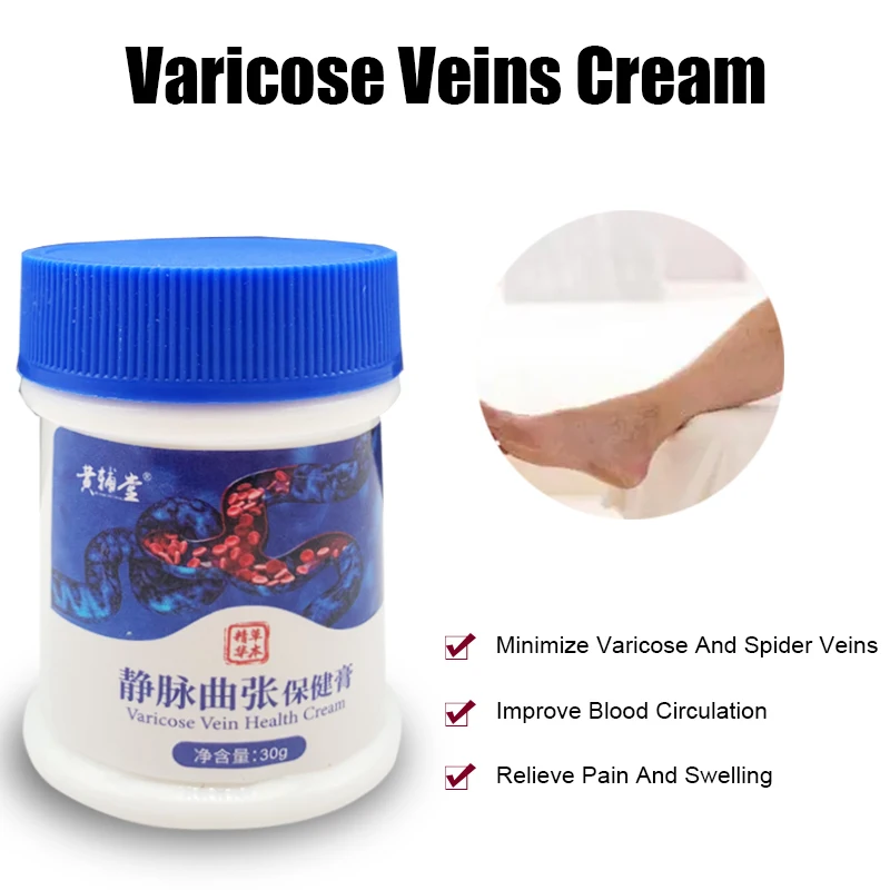 Giãn Tĩnh Mạch Kem Điều Trị Viêm Mạch Phlebitis Nhện Giảm Đau Tinh Dầu Varicosity Angiitis Loại Bỏ 100% Nguyên Bản Thảo Dược