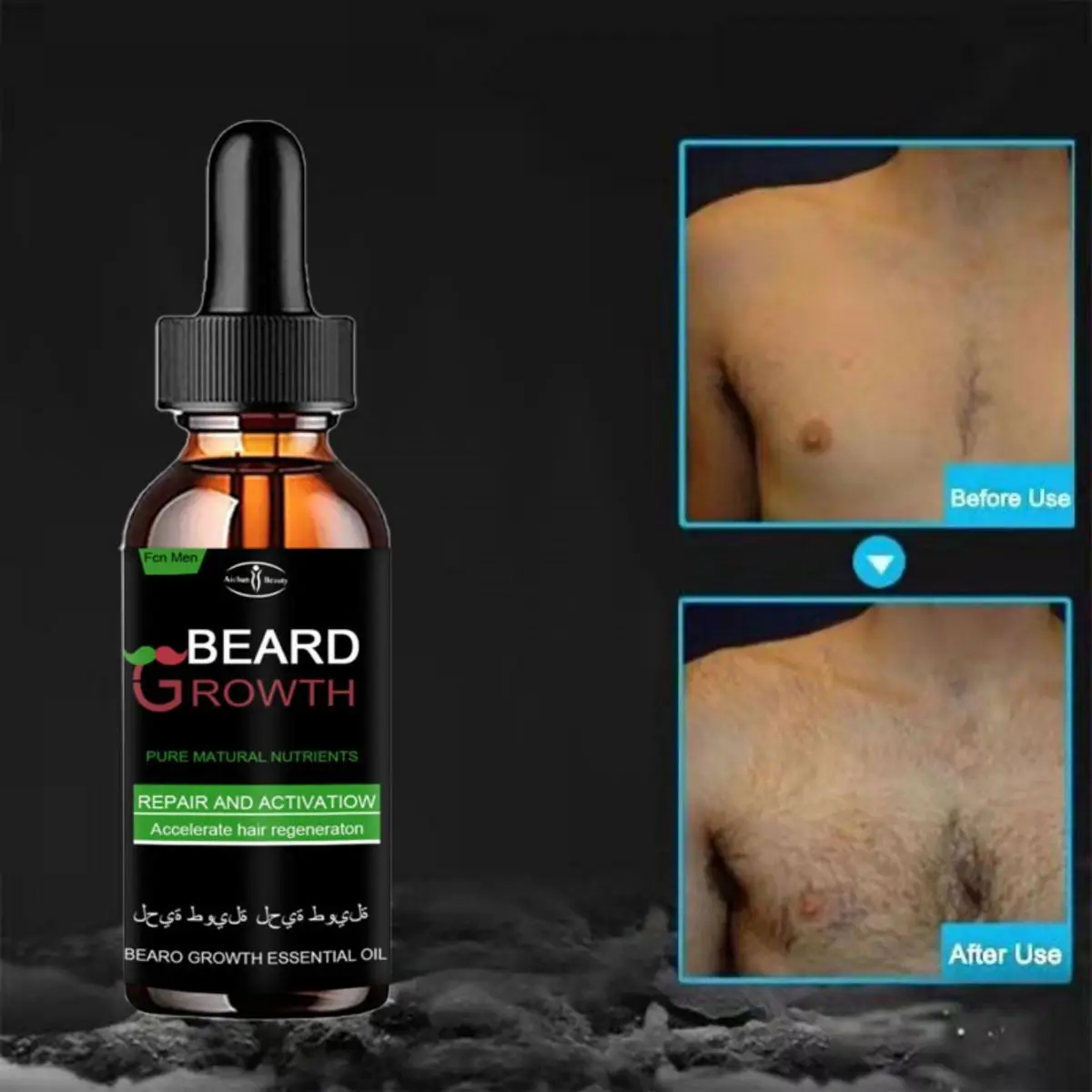 男性用ひげ用ボディ,10ml,あごひげ用,脱毛用,短納期