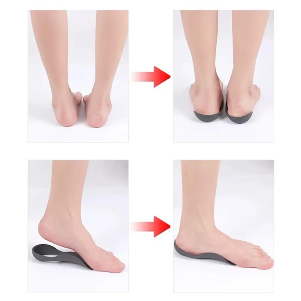 XO-Legs Solette ortopediche Plantari Piede piatto Salute Suola per scarpe Inserto Supporto per arco plantare per fascite plantare Cura dei piedi