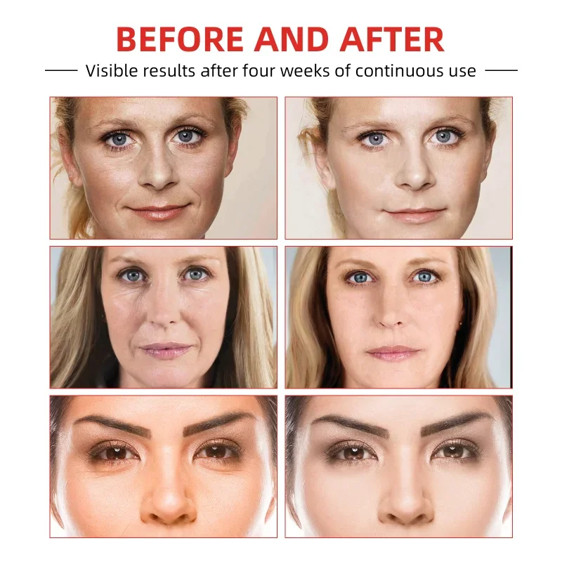 Instant Wrinkle Remover Face Cream Lifting Firming Fade Fine Lines Anti-aging Whitening Moisturizing Brighten Korean Cosmetics
