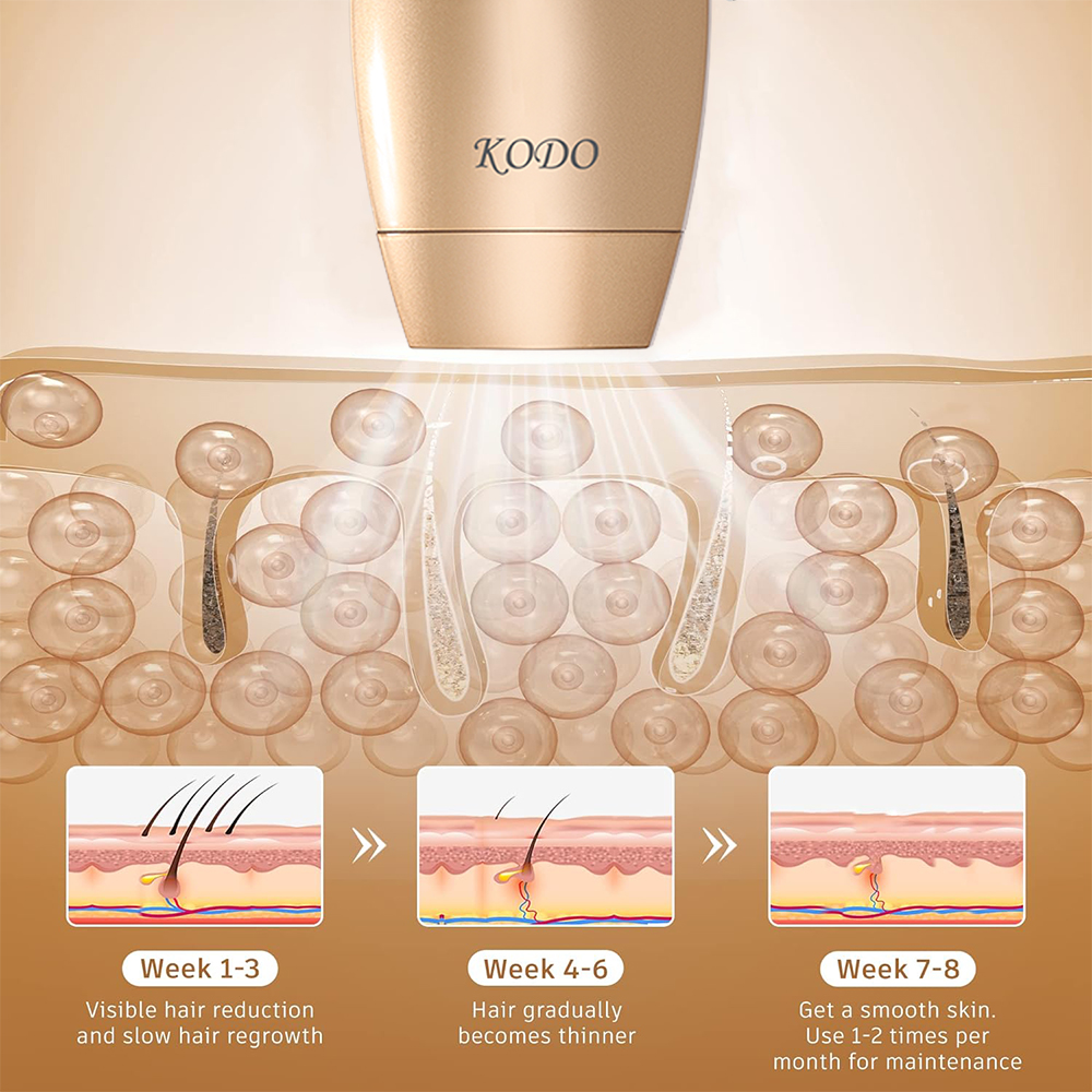 KODO 2024 High-end การปรับแต่งเลเซอร์น้ําแข็งกําจัดขนเลเซอร์กําจัดขนถาวร IPL ไม่เจ็บปวด Photoepilator 4 in 1 Face และ Body