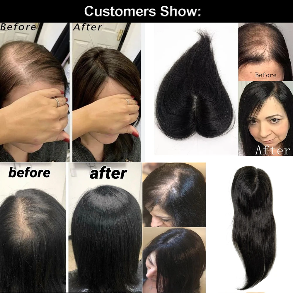 15x16cm mão amarrada base de seda remy clipe real em peruca de cabelo humano toppers para mulheres topper com desbaste extensão do cabelo humano russo