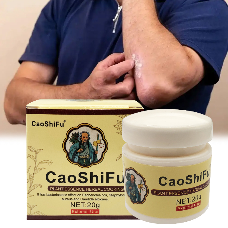 20g ZB Caoshifu medicina de hierbas chinas para Dermatitis ungüento eczematoide Psoriasis Urticaria crema para el acné cuidado de la piel