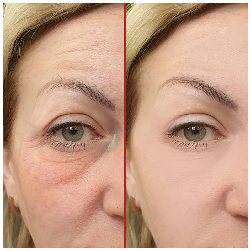 Retinol Wrinkle Removal Cream Fade Face Eye Fine Line Instant Anti Aging Whitening Anti-Wrinkle Dark Circles Dismiss Cream 30g