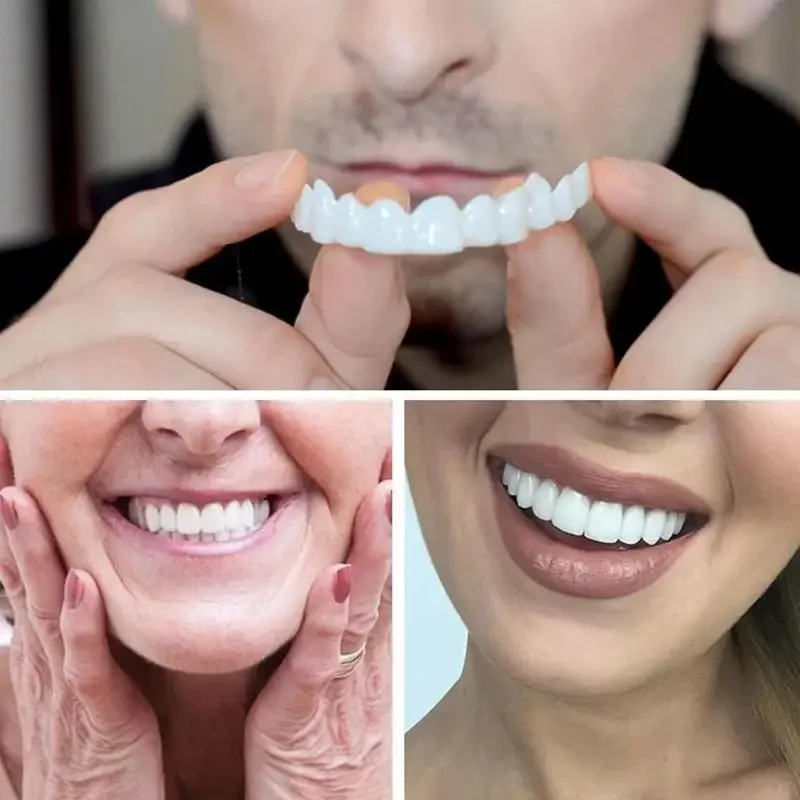 Sdatter Snap On Teeth Veneers 남성과 여성을 위한 틀니는 치아를 커버합니다. 즉각적인 자신감을 지닌 미소 임시 치아 구강 위생